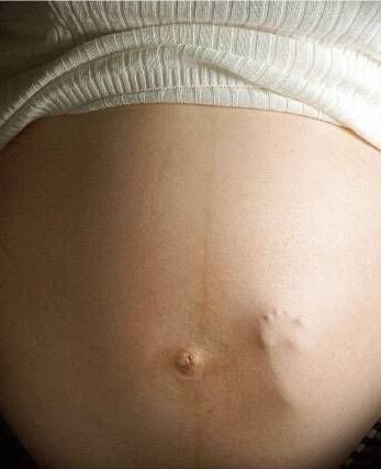 dark-line-on-stomach-not-pregnant