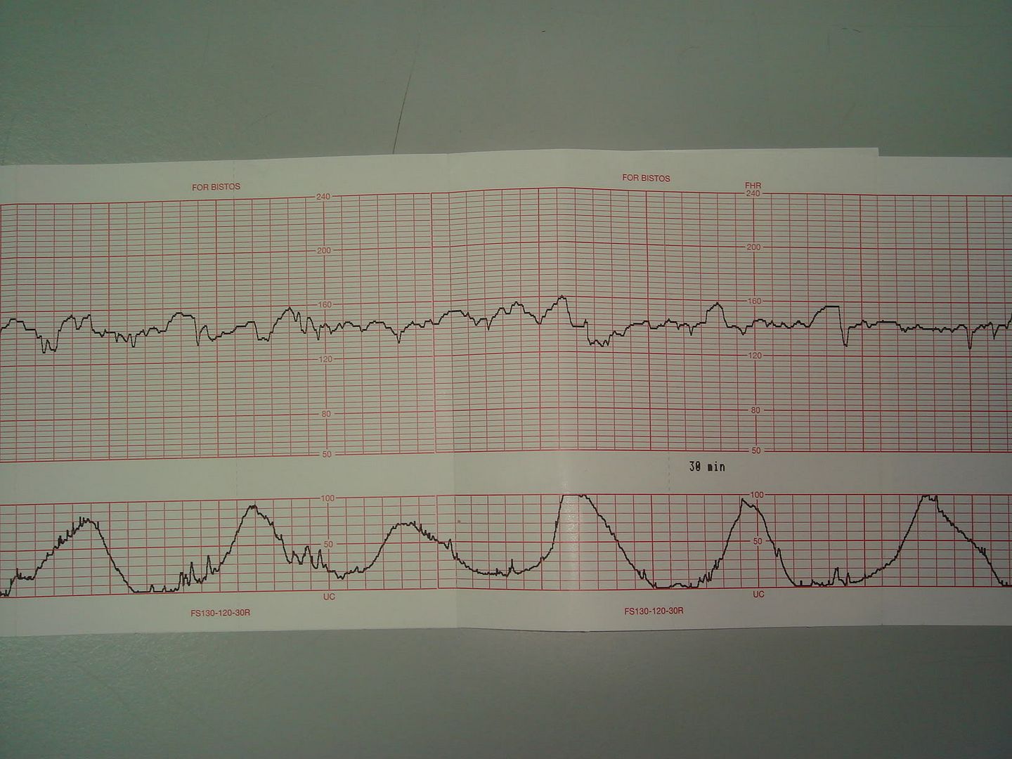 Ctg Graph