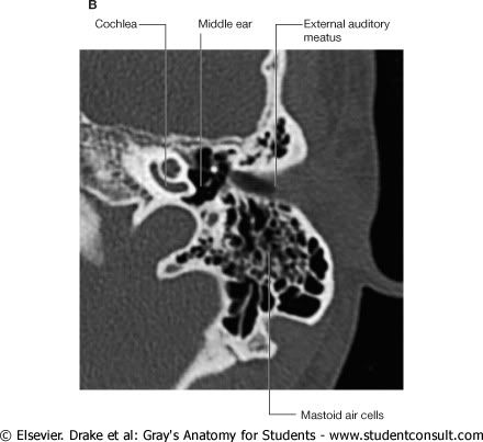 Ct+scanner+diagram