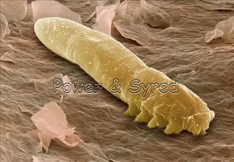 dust eyelashes mites
